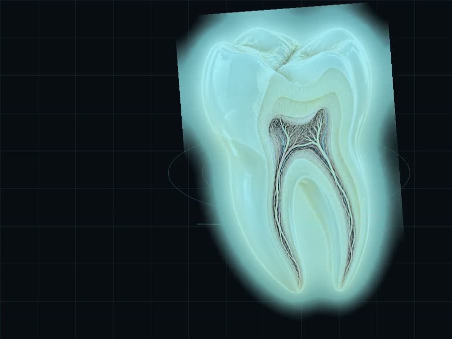 Digital dental scan